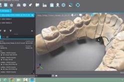 Un laborator de tehnică dentară din Bistrița se dotează cu tehnologie 3D de peste 1 milion de lei, prin fonduri europene