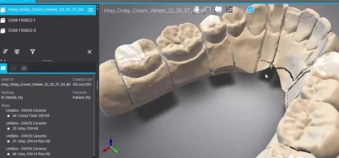 Un laborator de tehnică dentară din Bistrița se dotează cu tehnologie 3D de peste 1 milion de lei, prin fonduri europene