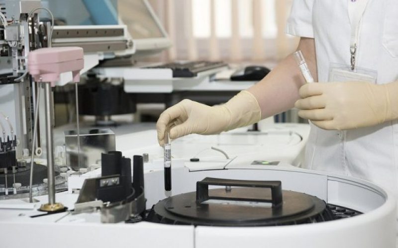 Spitalul Județean își cumpără propriul aparat de testat coronavirusul